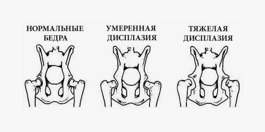 СНОВА О ДИСПЛАЗИИ